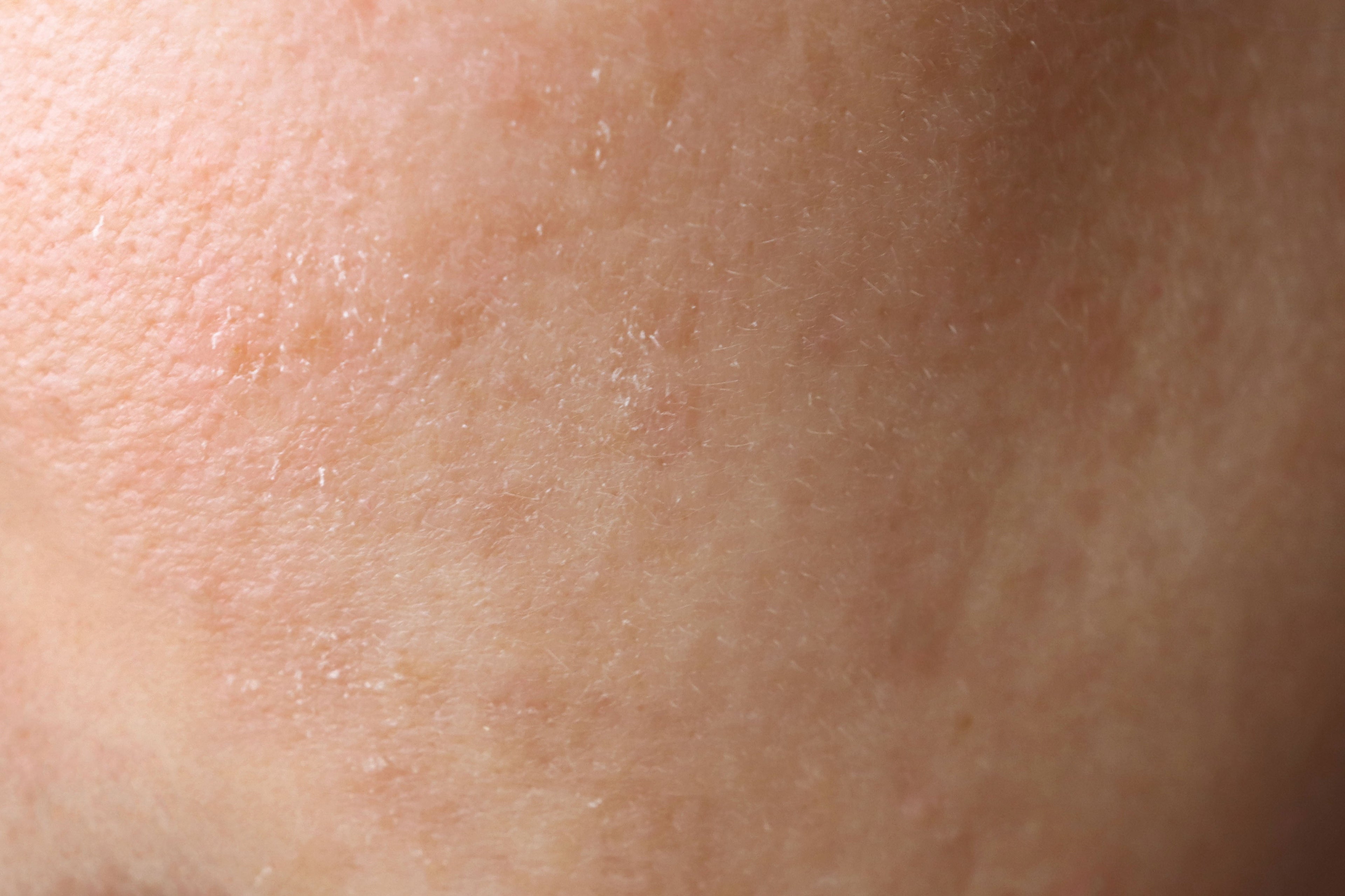 Beef Tallow & Skin Repair